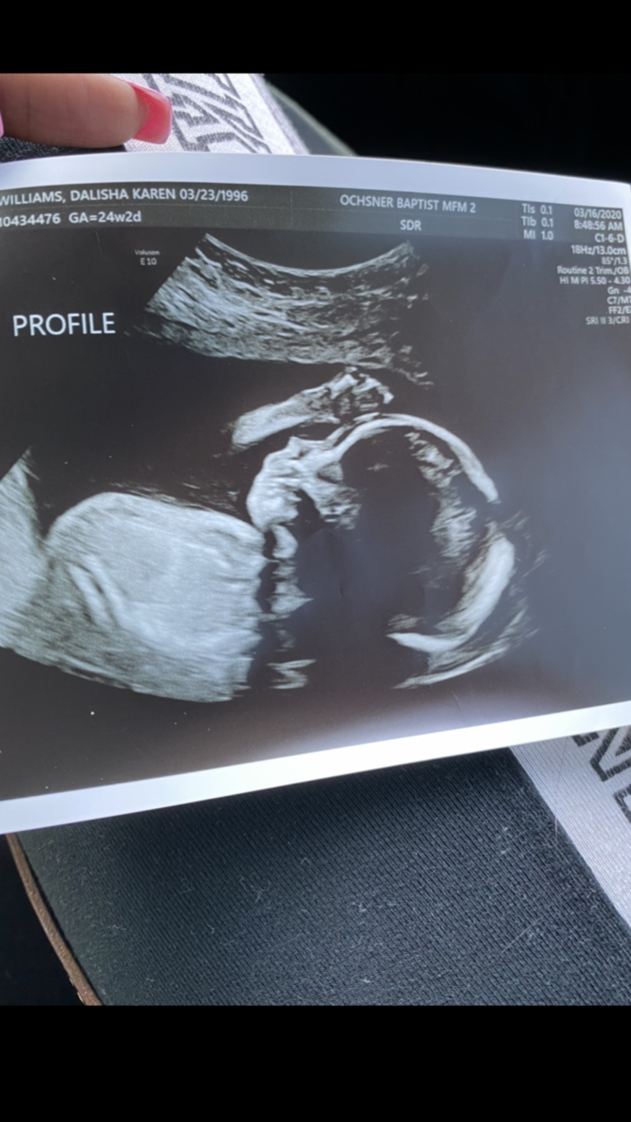 18K Engraved Photo Necklace